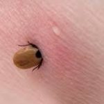 teek_lyme